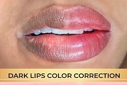 Permanent lip colour correction