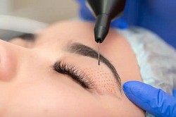 Laser blepharoplasty, eyelid tightening