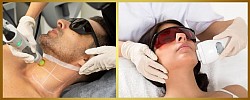 Permanent Laser hair reduction