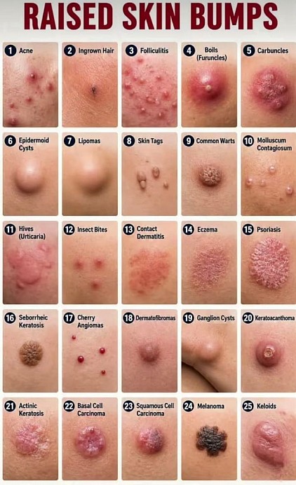 Skin lesions